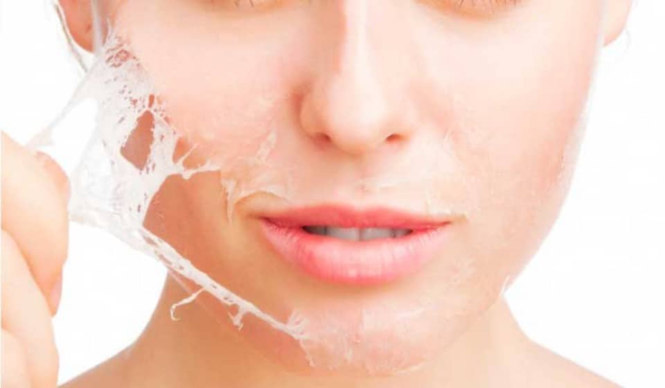 Peeling de diamante